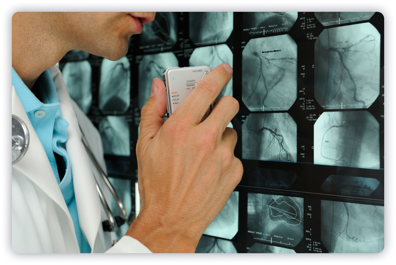 How Voice Recognition is Changing the Landscape of Radiological Diagnostics